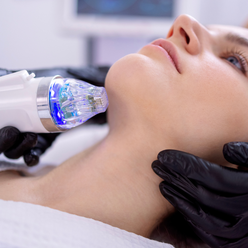 Radiofrekwencja mikroiglowa - zabieg