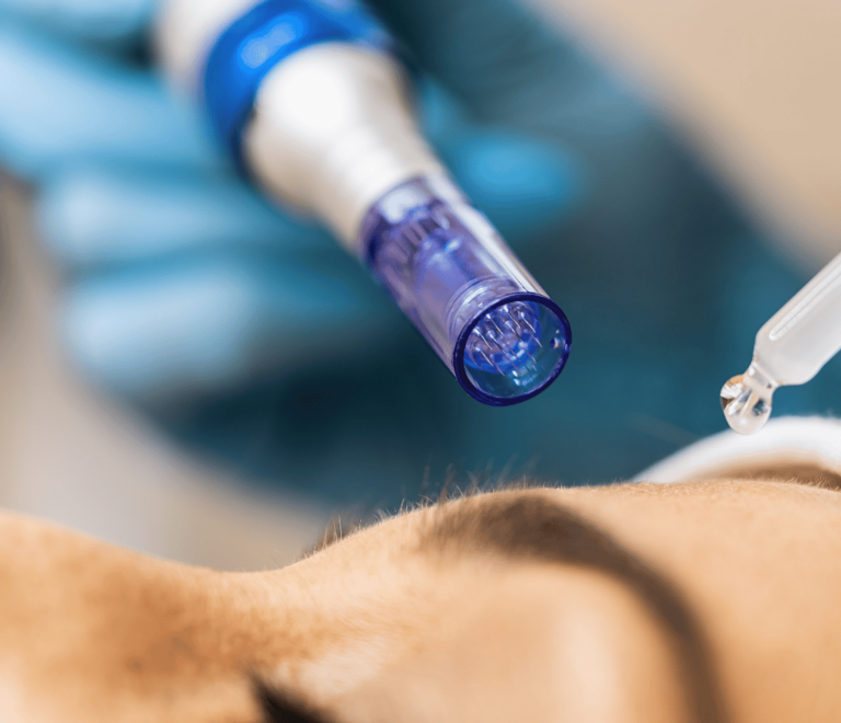 Mezoterapia mikroigłowa