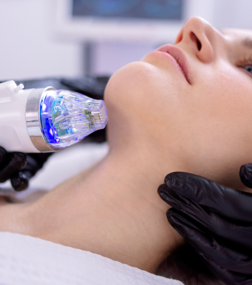 Radiofrekwencja mikroiglowa - zabieg